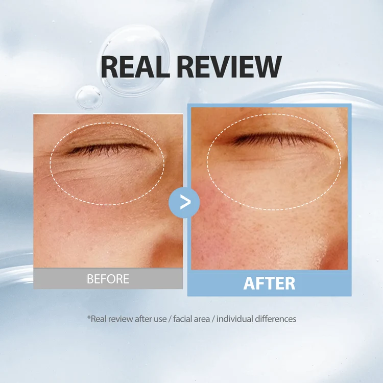 Volufiline Collagen Face Serum – Hydrating Niacinamide Anti-Aging &amp; Smoothing Facial Serum